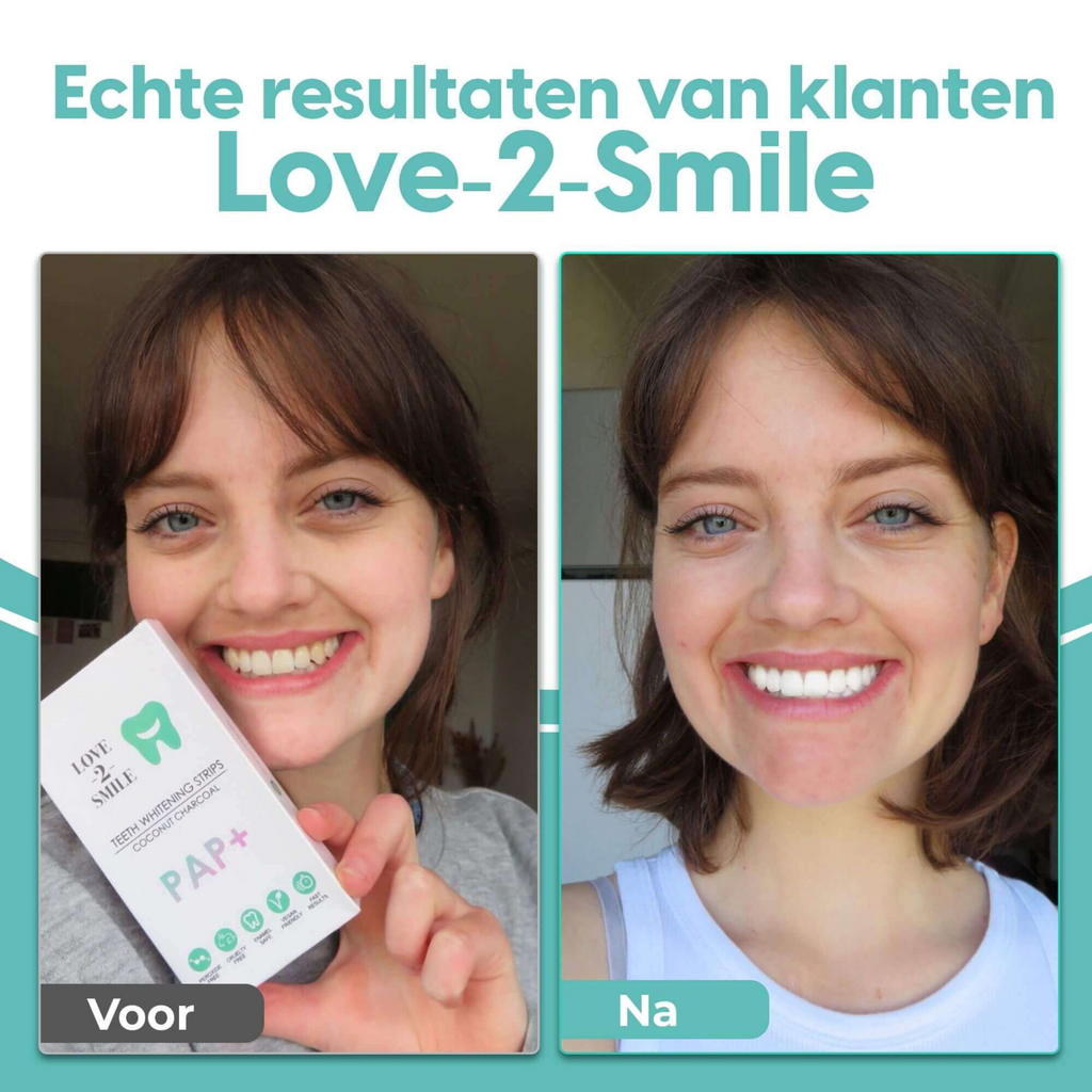 Whitening strips